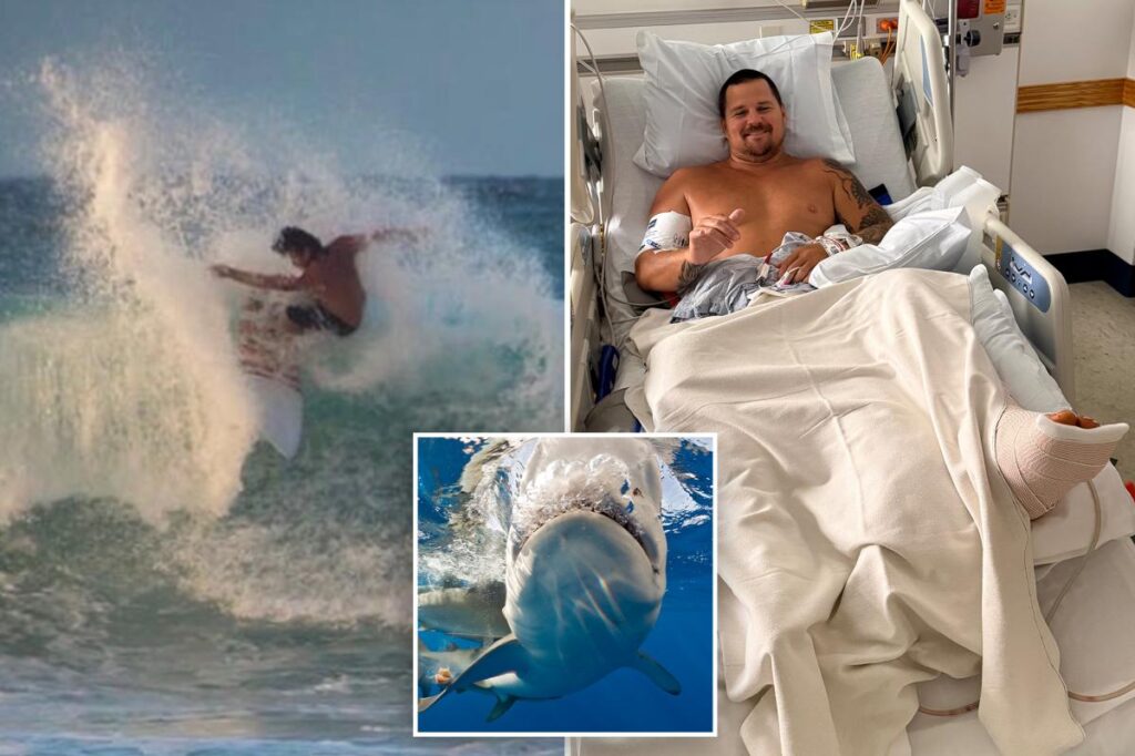 Surfer describes how 8-foot shark ripped open his legs: ‘My calf is pretty much wide open’