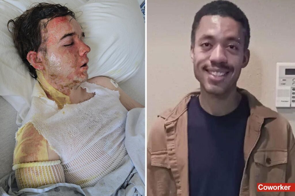 California McDonald’s boss breaks silence after coworker scalded him with boiling hot oil: ‘One of the hardest things of my life’ California McDonald’s boss breaks silence after coworker scalded him with boiling hot oil: ‘One of the hardest things of my life’