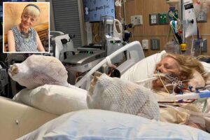 82-year-old mother suffers severe burns ‘down to the muscle and the bone’ after falling asleep by pool