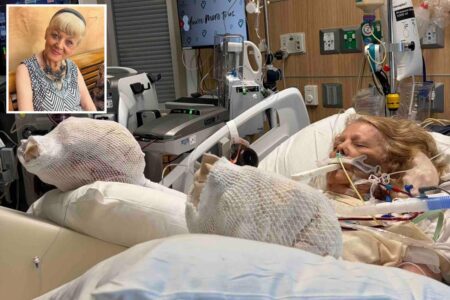82-year-old mother suffers severe burns ‘down to the muscle and the bone’ after falling asleep by pool