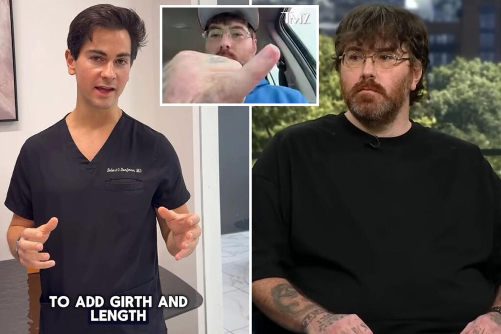 Owner of world’s smallest penis gets shot at personal growth from plastic surgeon