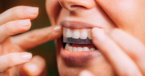 Run! The Bestselling Whitening Strips for Sensitive Teeth Just Hit Their Lowest Price of the Year