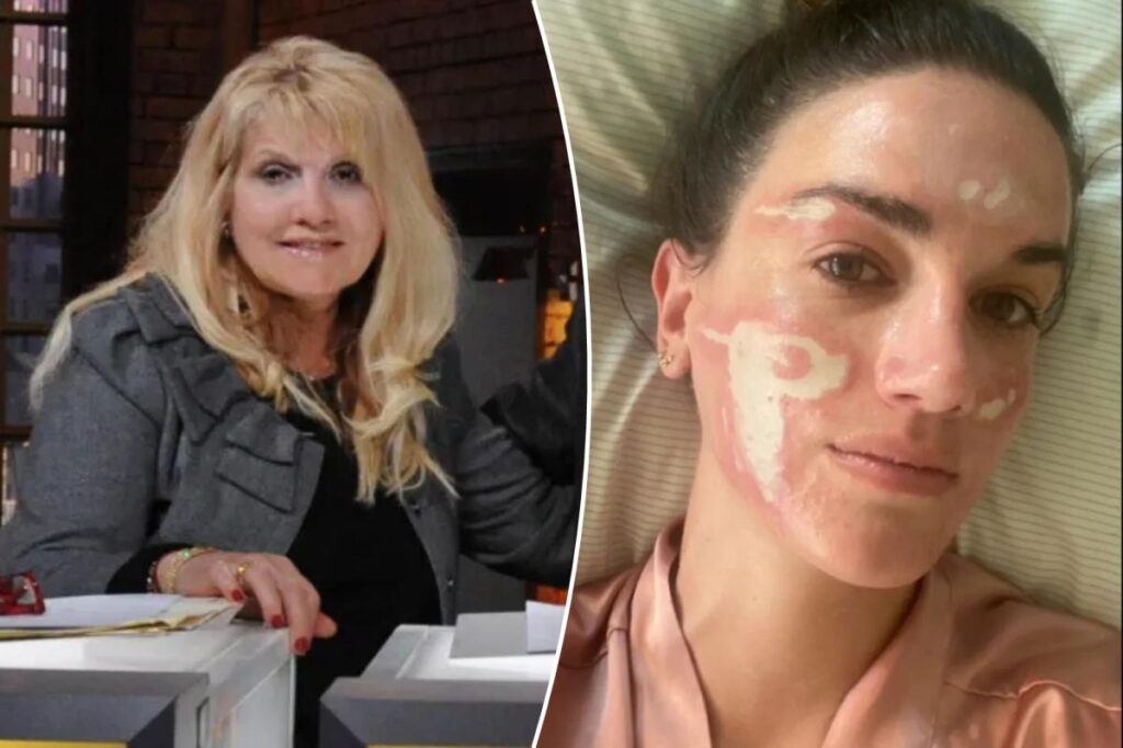 Celebrity esthetician loses her license after client says she was left ‘permanently scarred’