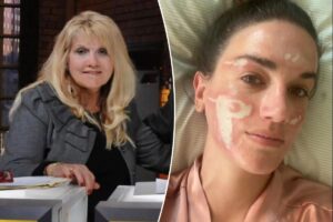 Celebrity esthetician loses her license after client says she was left ‘permanently scarred’