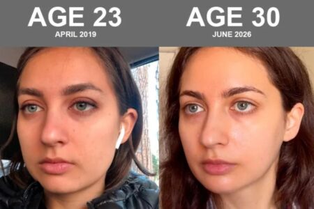 30 going on 21: Bryan Johnson’s girlfriend reveals extreme biohacking that made her skin age backwards