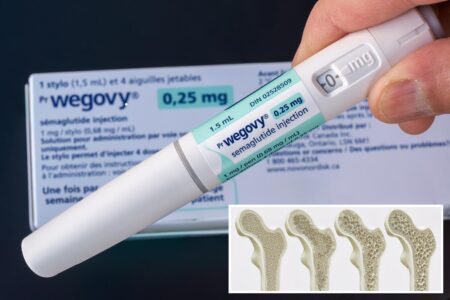 Ozempic and Wegovy may strengthen bones in Type 2 diabetes patients, study finds