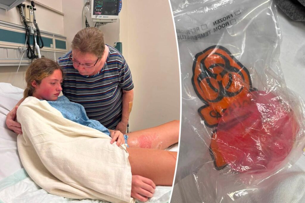 Child lets out ‘blood-curdling scream’ after getting scalded by popular exploding toy left in hot car