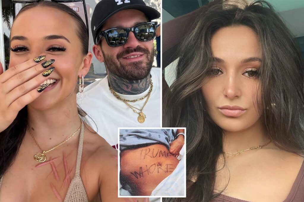 Ex-NJ GOP aide accused of staging slashing attack shows off horrific scars — and mystery man — in new snap Ex-NJ GOP aide accused of staging slashing attack shows off horrific scars — and mystery man — in new snap