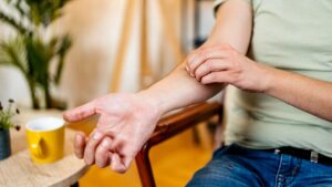 Why scratching a mosquito bite makes it so much worse, according to science