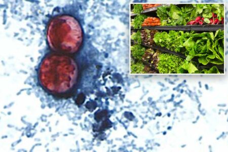 ‘Explosive diarrhea’ parasite spreads to 50 in Suffolk County as Long Island deals with duel outbreaks ‘Explosive diarrhea’ parasite spreads to 50 in Suffolk County as Long Island deals with duel outbreaks