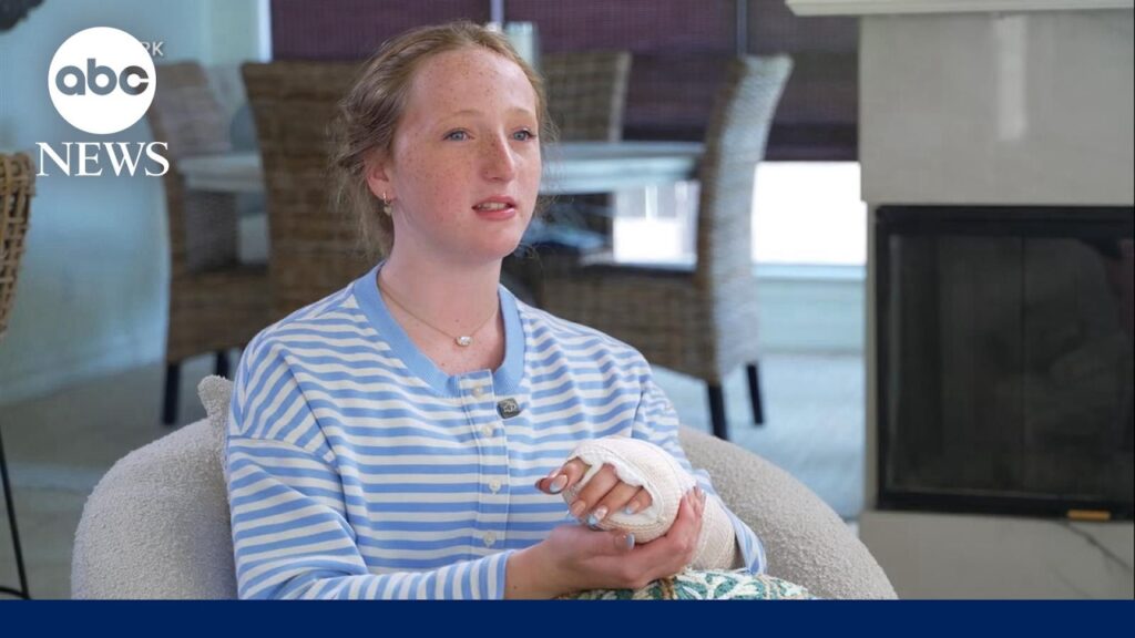 Teen speaks out after barracuda attack