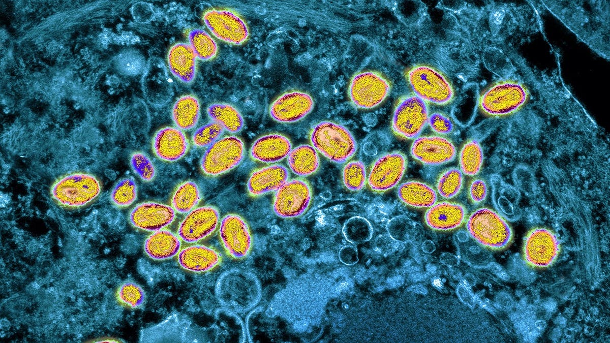 View of smallpox under microscope