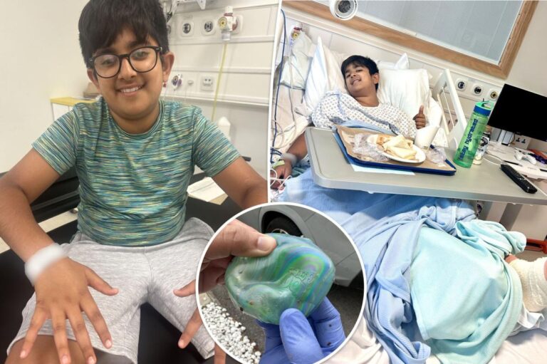 Boy, 12, undergoes skin graft after sun exposure caused popular toy to explode Boy, 12, undergoes skin graft after sun exposure caused popular toy to explode