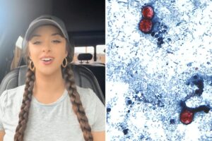 TikTok food critic, 29, details ‘miserable’ experience of contracting ‘explosive diarrhea’ parasite