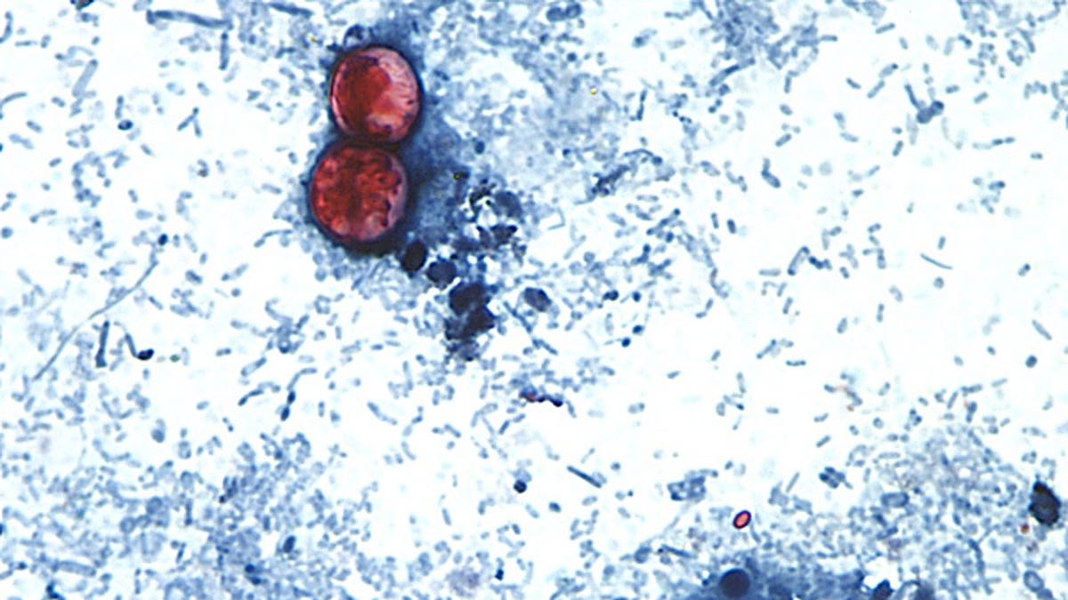 Cyclospora cayetanensis oocysts viewed through a microscope in a stool sample.