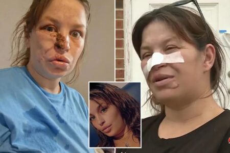 Pregnant woman needed ‘face put back together’ after savage attack by neighbor’s pit bulls: ‘Almost cost three lives’