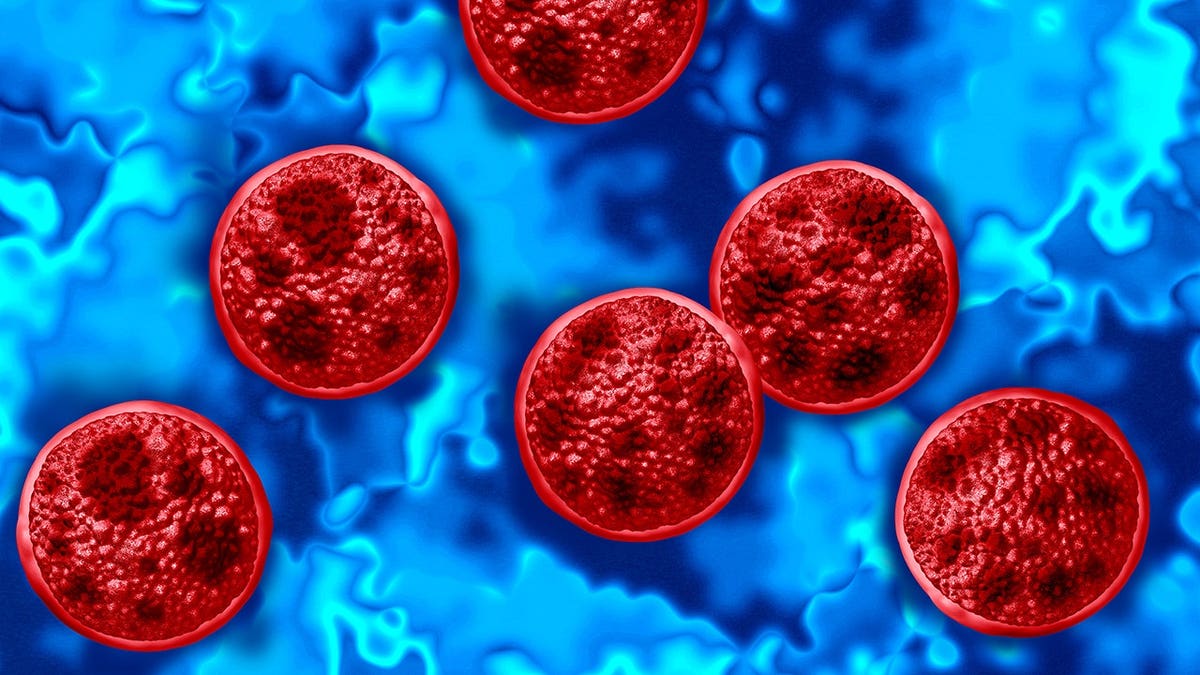 Cyclosporiasis outbreak illustration