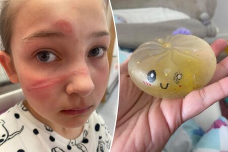 Popular squishy toy recalled over ‘serious injury’ hazard after months of child hospitalizations