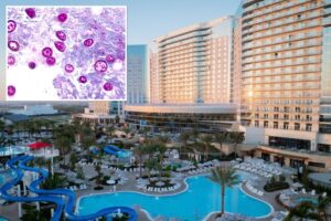 Highly contagious SoCal parasite outbreak linked to .3B resort pools under investigation Highly contagious SoCal parasite outbreak linked to .3B resort pools under investigation