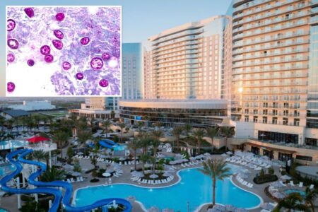 Highly contagious SoCal parasite outbreak linked to .3B resort pools under investigation