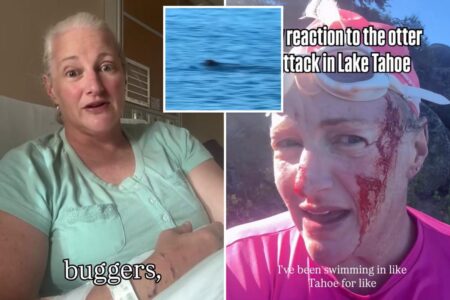 Lake Tahoe swimmer attacked by ‘ruthless’ otter undergoes surgery