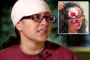 Woman accused of biting chunk out of victim’s forehead in ‘zombie bite’ attack Woman accused of biting chunk out of victim’s forehead in ‘zombie bite’ attack
