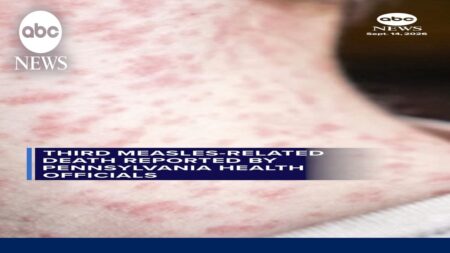 Third measles-related death reported by Pennsylvania health officials