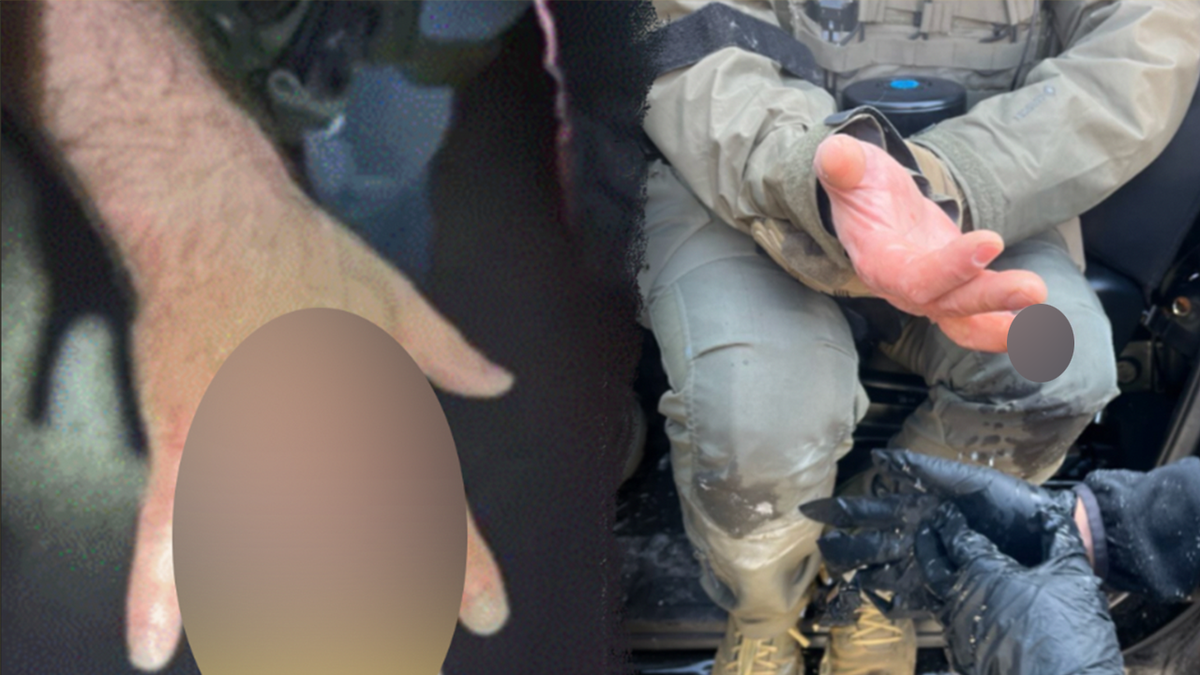 Injured ICE agents.