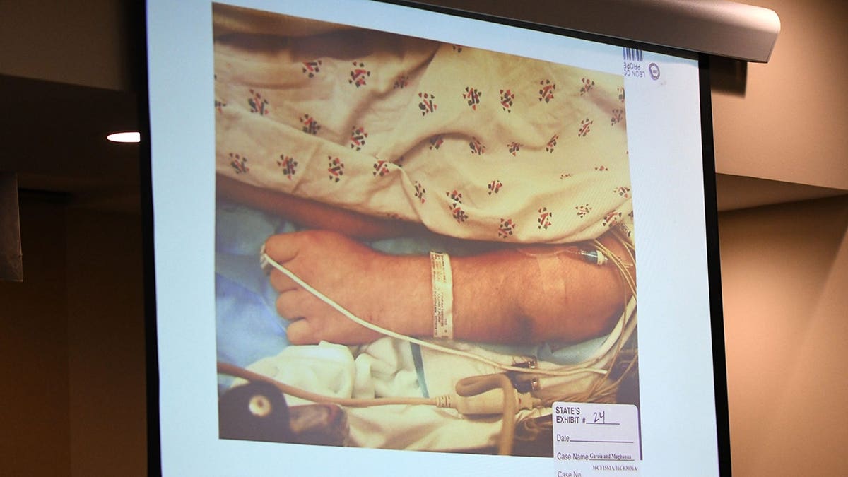 Dan Markel's arm displays residue consistent with firearm discharge.