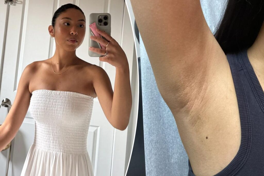I developed a nasty skin condition from shaving my underarms — you could be making the same mistake I did I developed a nasty skin condition from shaving my underarms — you could be making the same mistake I did